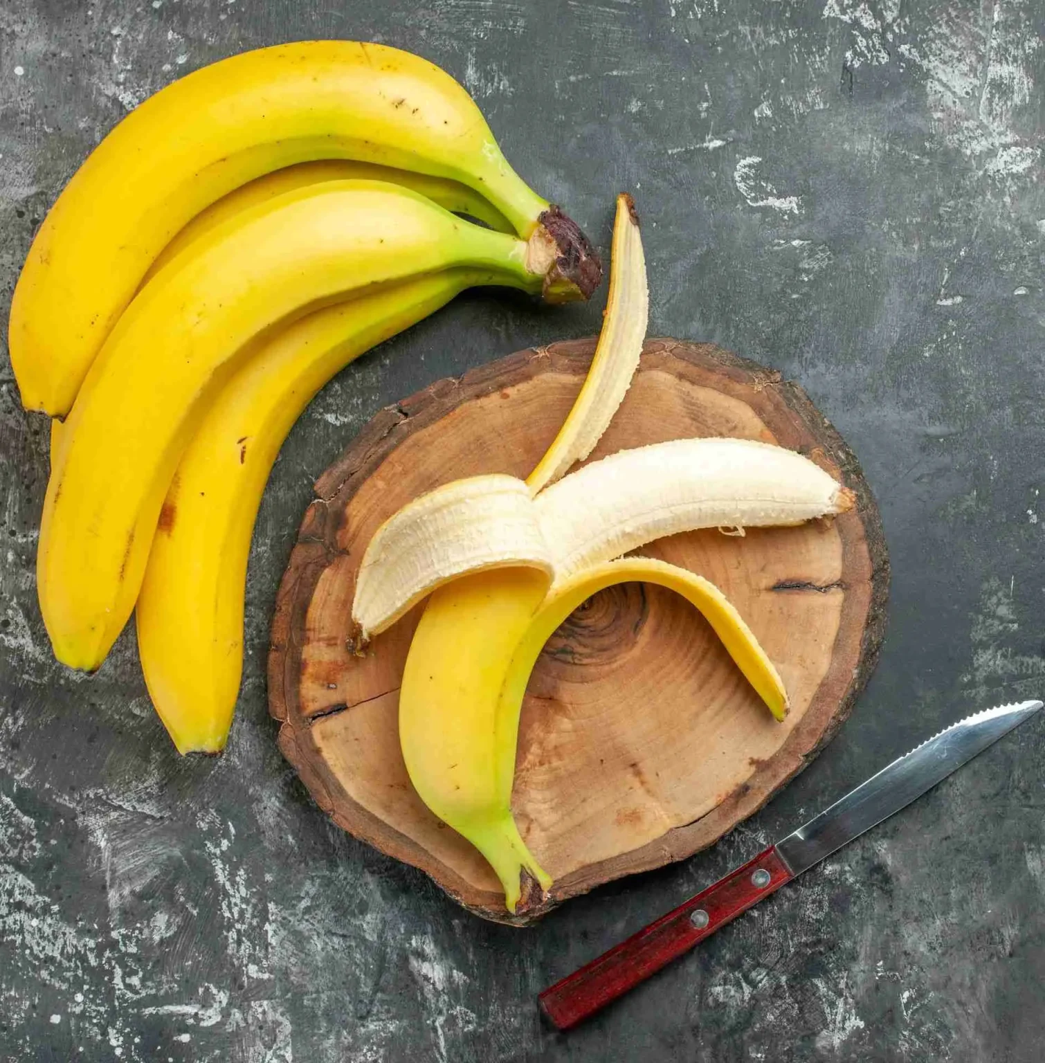Banane e diabete Banane e diabete